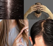 Varieties of hair issues: And  eliminate hair issues?