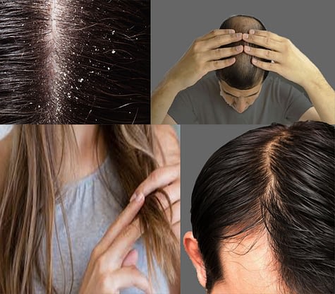 Types Or Hair Problems