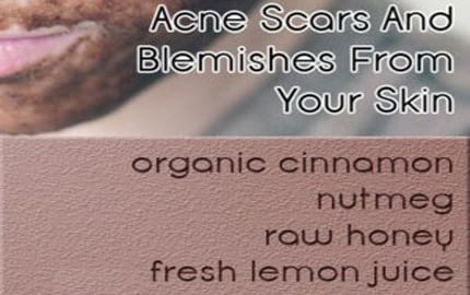 Face Mask To Get Rid Of Acne Scars