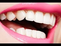 White Teeth Wp