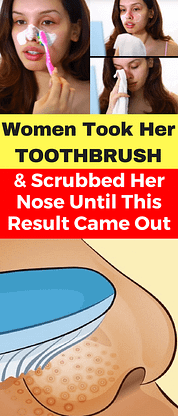The Woman Took Her Toothbrush And Scrubbed Her Nose Until This Result Came Out Min