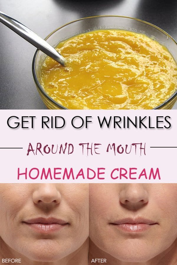 Get Rid Of Wrinkles Around The Mouth #Beauty #Health #Wrinkles