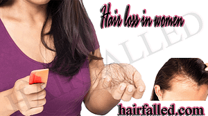 Hair loss in girls information: Causes, Signs, Remedy