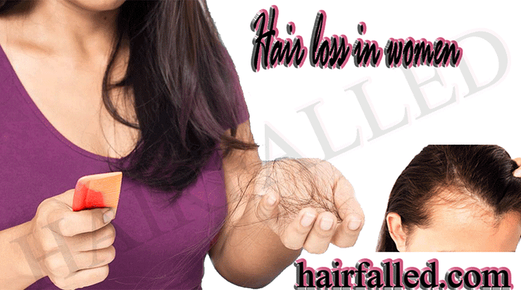 Hair Loss In Women Guide 1